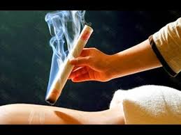 moxibustion